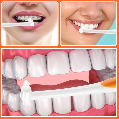 Ouligay 5Pcs Tuft Toothbrush Tufted Brush End-tuft Interspace Toothbrushes Single Tufted Toothbrush Soft Compact Interdental Toothbrush for Orthod...