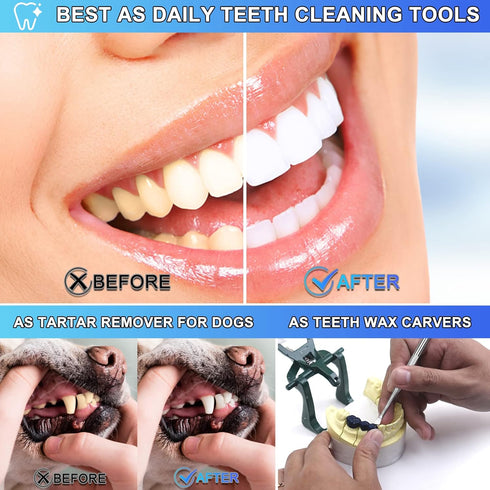 Dental Tools, 3 Pack Teeth Cleaning Tools Stainless Steel Dental Scraper, Pick Hygiene Set for Dentist, Personal Using, Family Oral Care, Pets, Ca...