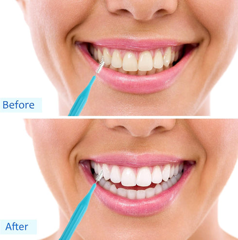 100 Pieces Braces Brush for Cleaner Interdental Brush Toothpick Dental Flossing Head Oral Hygiene Flosser Tooth Cleaning Tool (Light Blue, Yellow,...