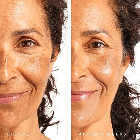 Tree of Life Refining Niacinamide Serum (Vitamin B3) Facial Serum with Hydrating Hyaluronic Acid; Refine & Balance Skin + Minimize Pores, Clean Dermatologist-Tested Skin care, Bonus Size 2 Fl Oz